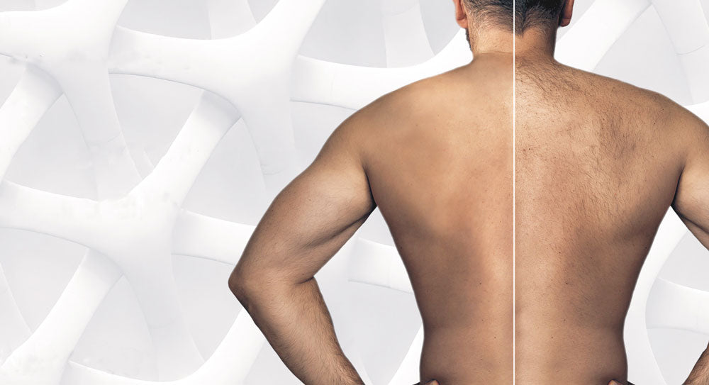 Laser Hair Package (6)
