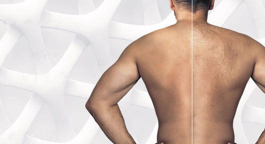 Laser Hair Package (6)