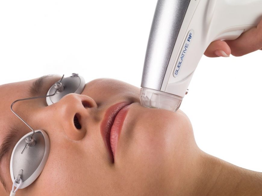 PhotoFacial (IPL)